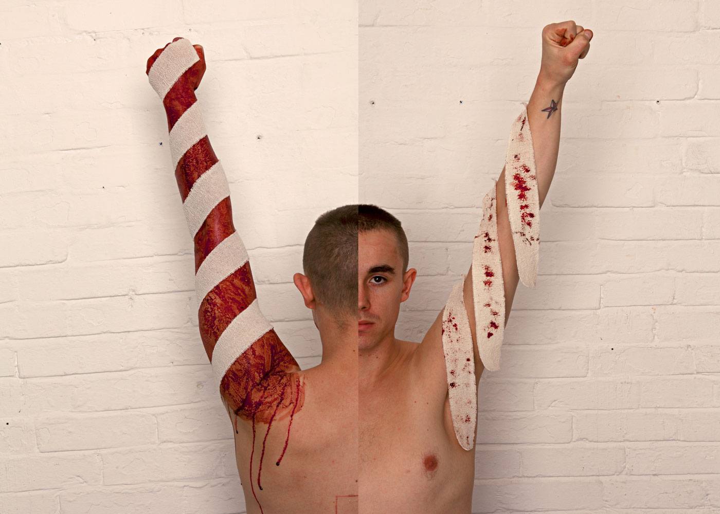 A split frame image; on the left the artist back is facing the camera with their right arm raised and their hands clutched into a fist. Their arm is covered in blood with white bandage wrapped around their arm. On the right the artist is facing the camera with the same arm raised where the arm is not covered in blood, but the bandage wrapped around their arm is.